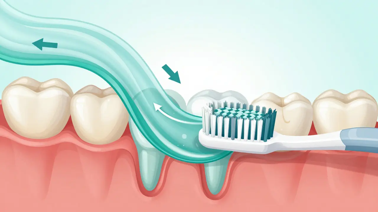 Křížový řez zubů a dásní ukazující, jak sonické vibrace odstraňují plak mikroprůtoky.